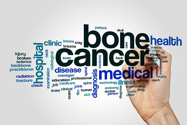 سرطان استخوان-تومورهای استخوانی