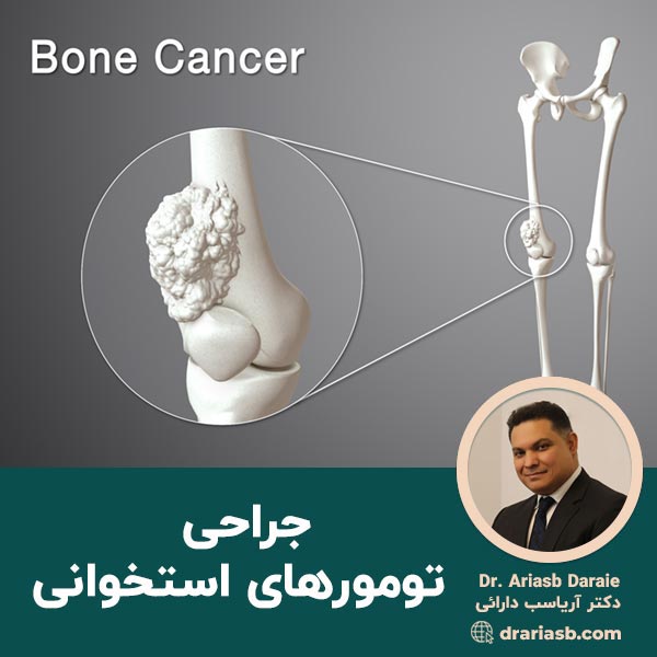درمان-جراحی-تومورهای-استخوانی